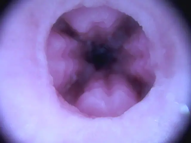 ももわれの内部スコープ画像